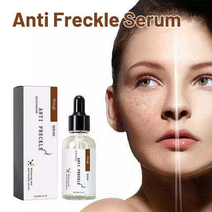 FadeAway Anti-Freckle Serum (30 ml)